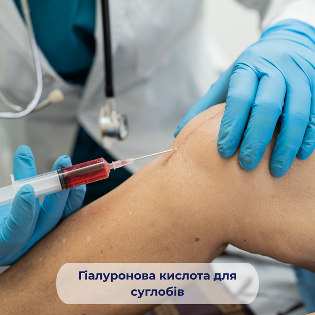 Гіалуронова кислота для суглобів — внутрішньосуглобові ін'єкції при остеоартрозі